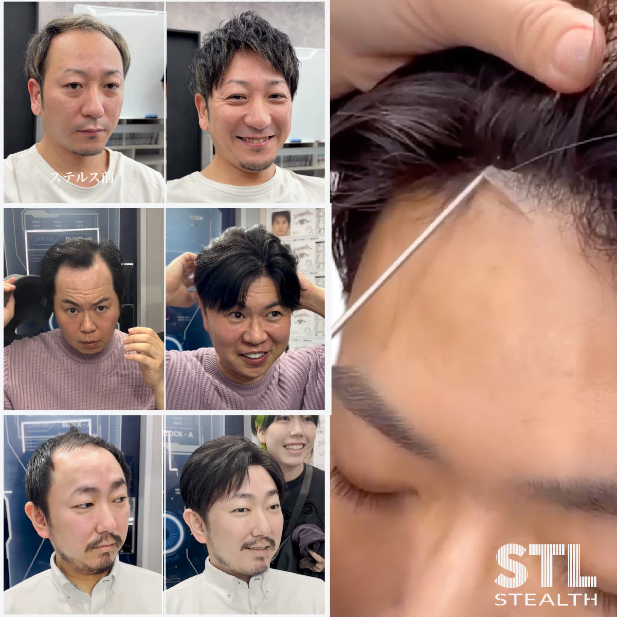 STL-3_お取寄せ（通常/急ぎ）